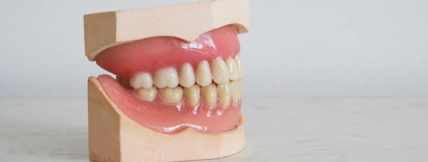 denture